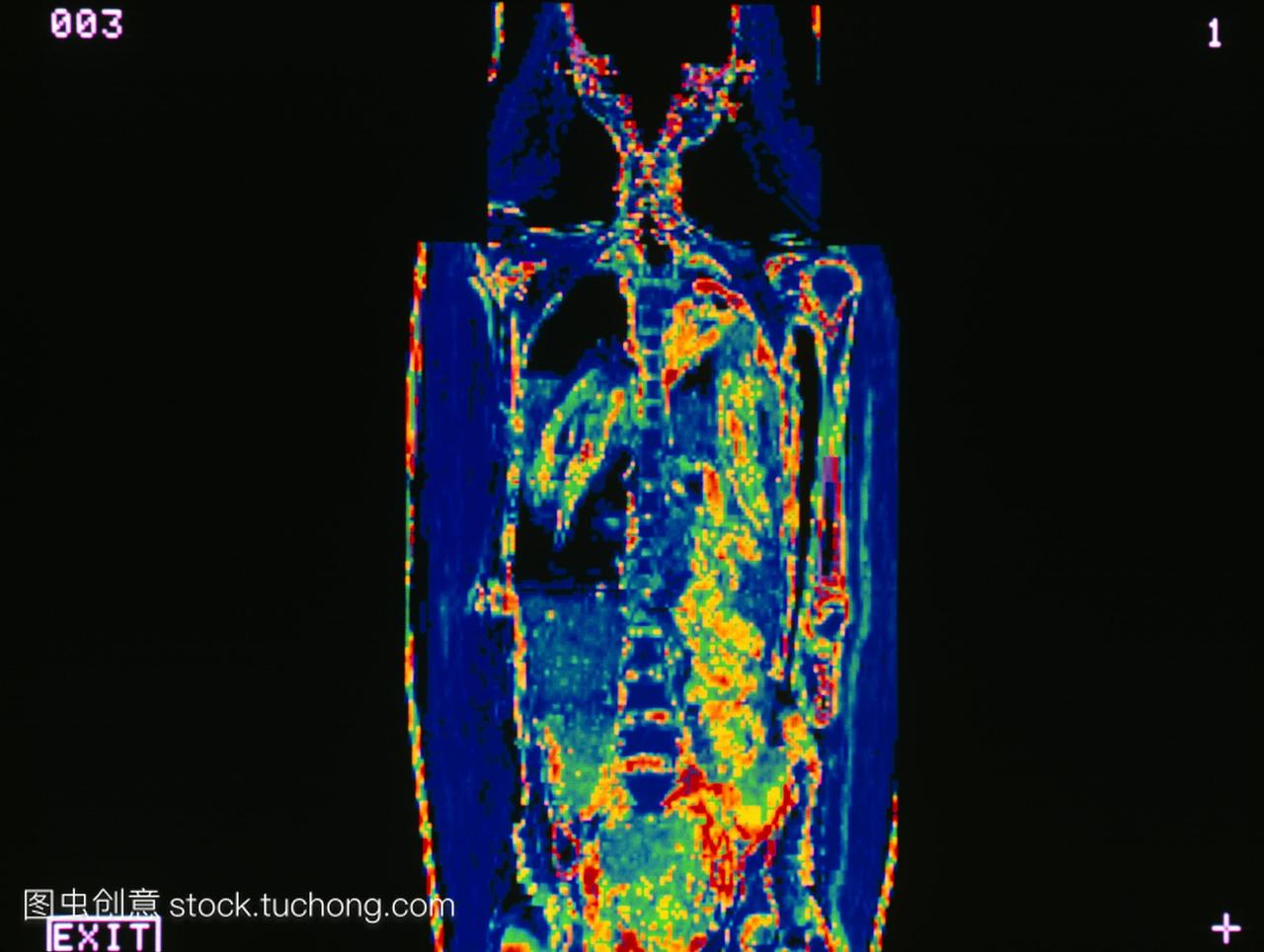 通过ct计算机断层扫描x射线数据采集的埃及木