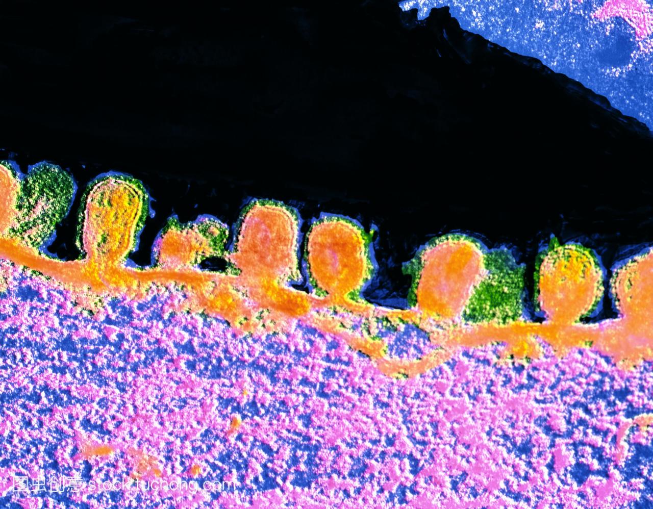 伪彩色透射电子显微镜TEM流感病毒橙色萌芽