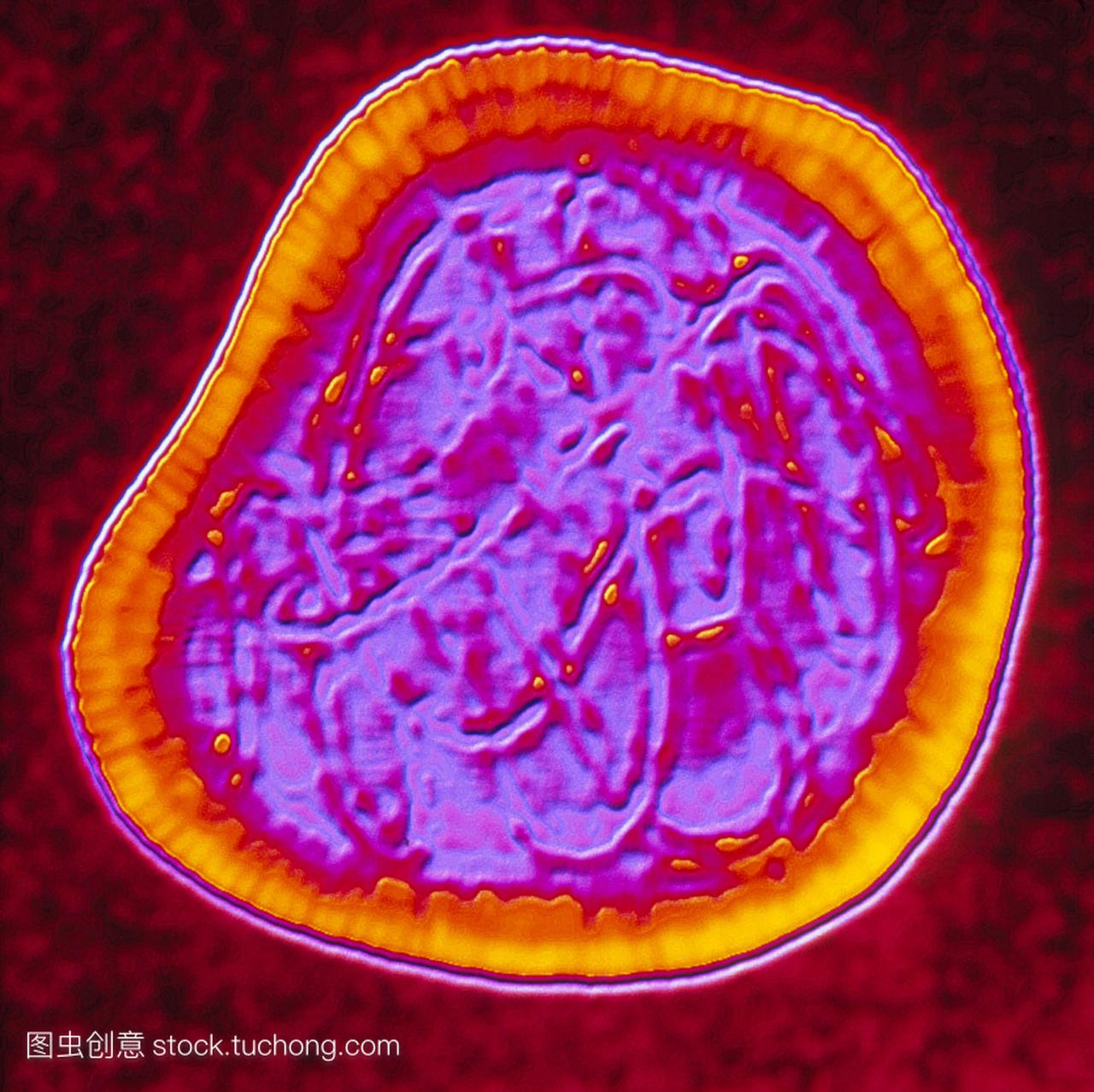 风疹病毒彩色透射电子显微镜tem单一风疹病毒