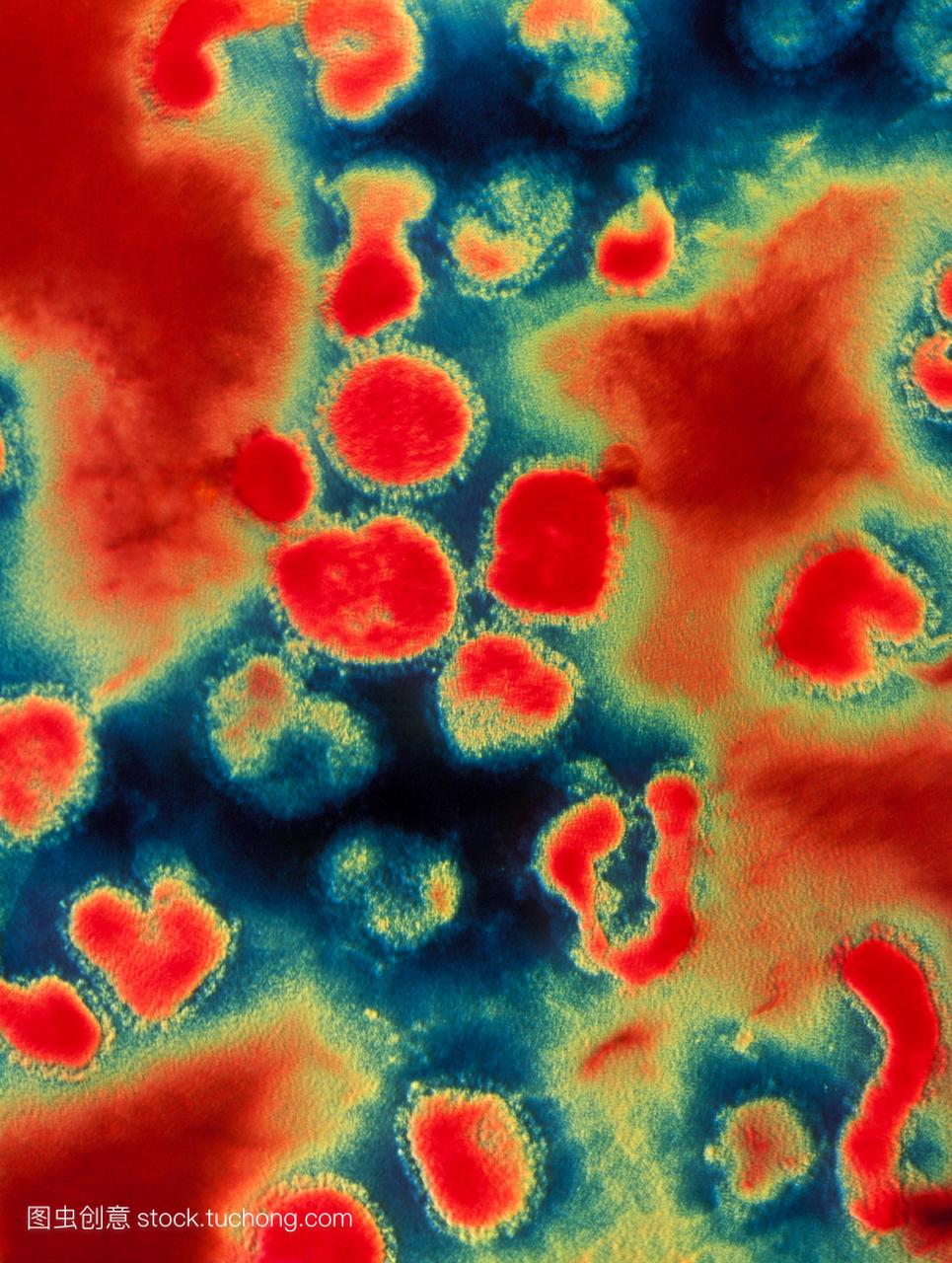 流感病毒彩色透射电子显微镜tem北京流感病毒
