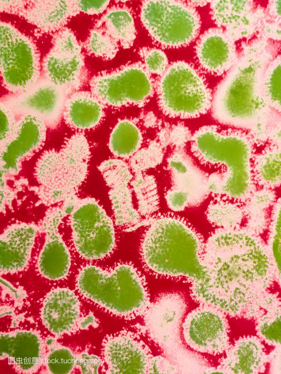 亚洲流感病毒的透射电子显微照片的亚洲流感猪