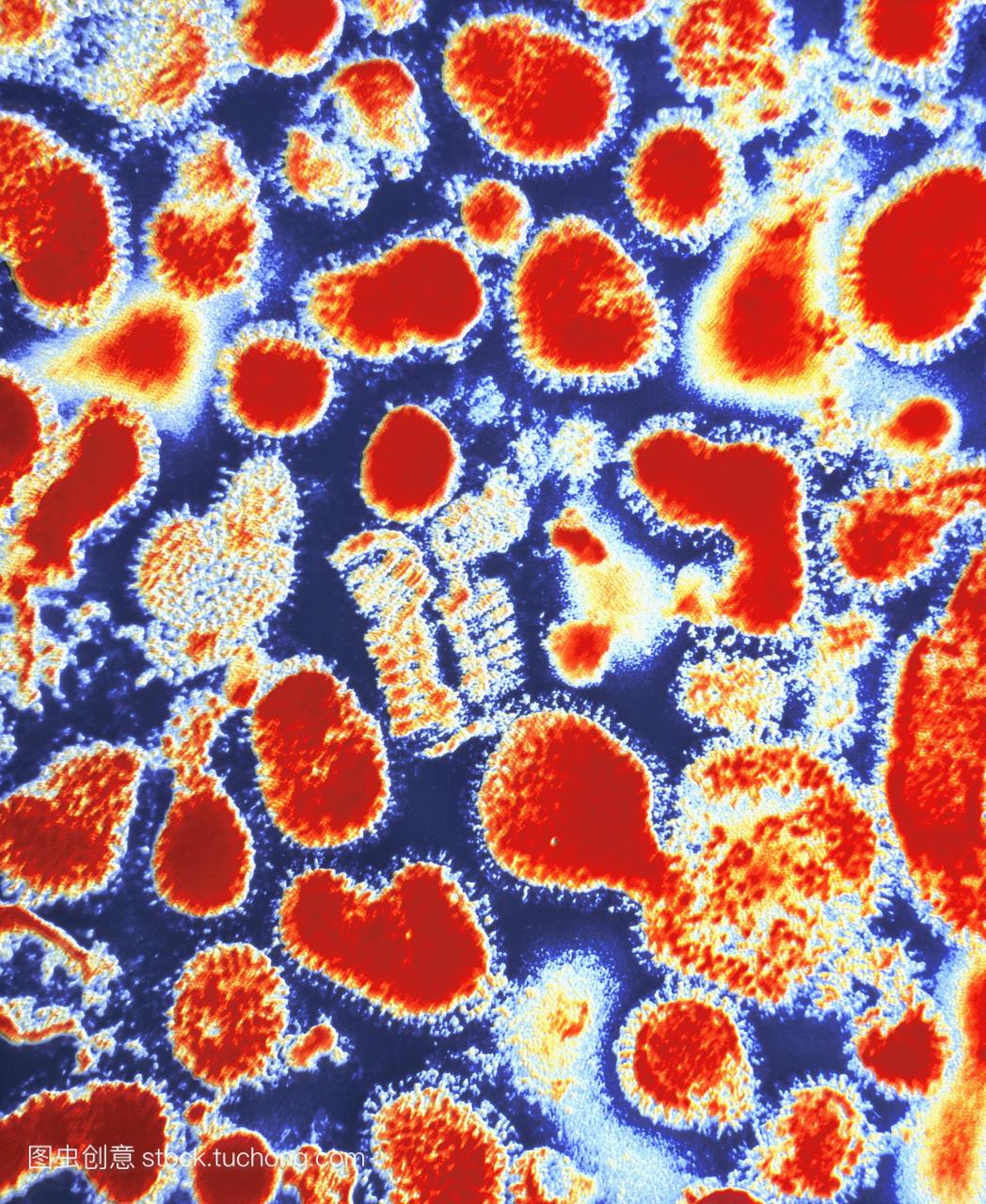 亚洲流感病毒。彩色透射电子显微摄影的亚洲流