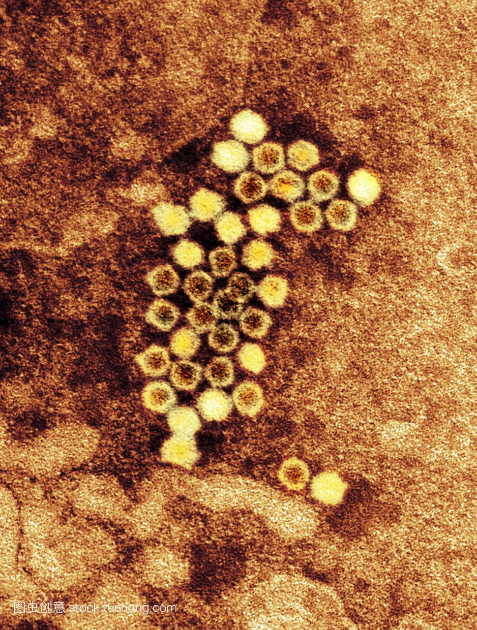 人类bocavirus粒子,彩色透射电子显微图tem。