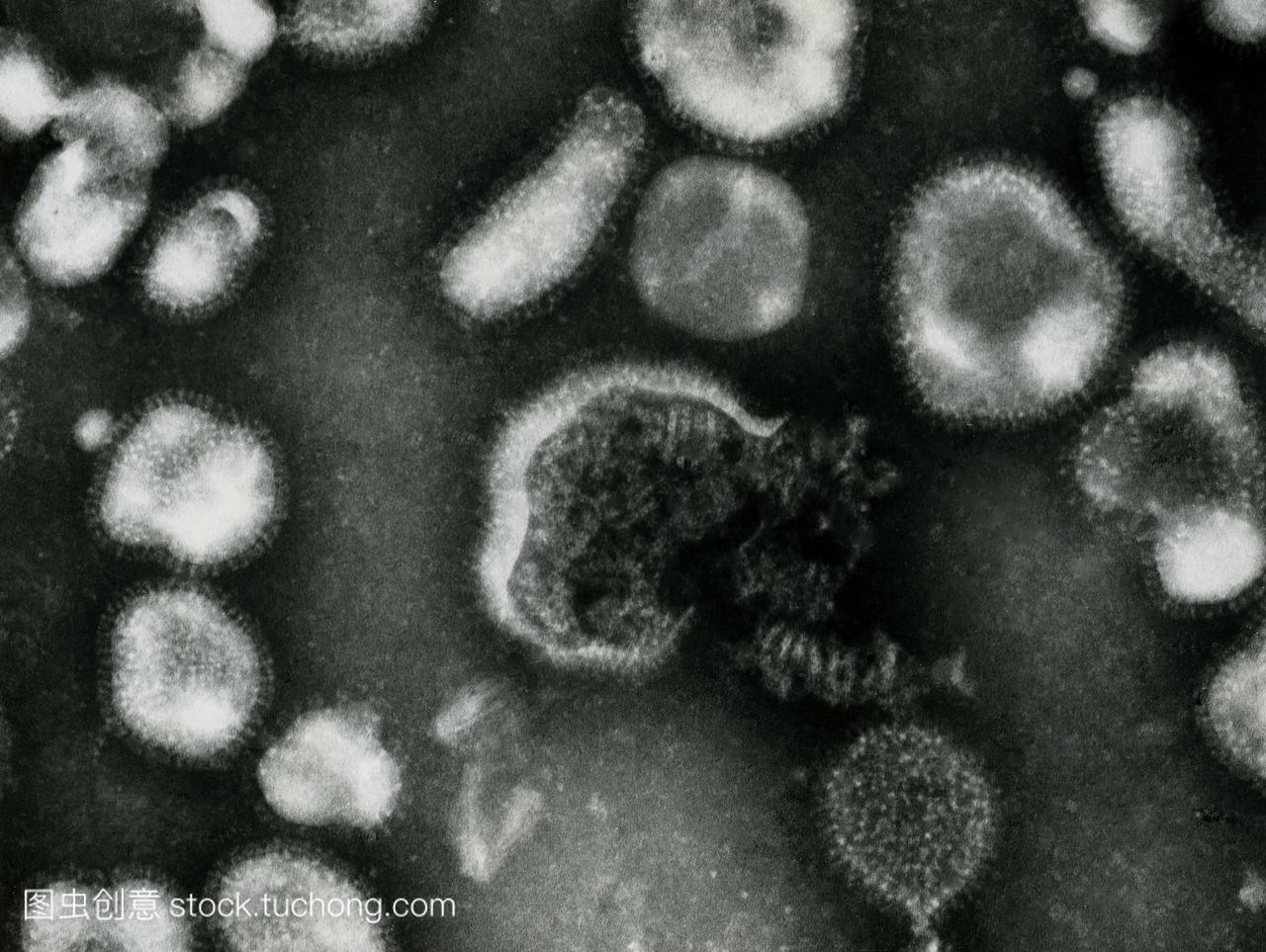 禽流感病毒。透射电子显微照片的禽流感病毒。