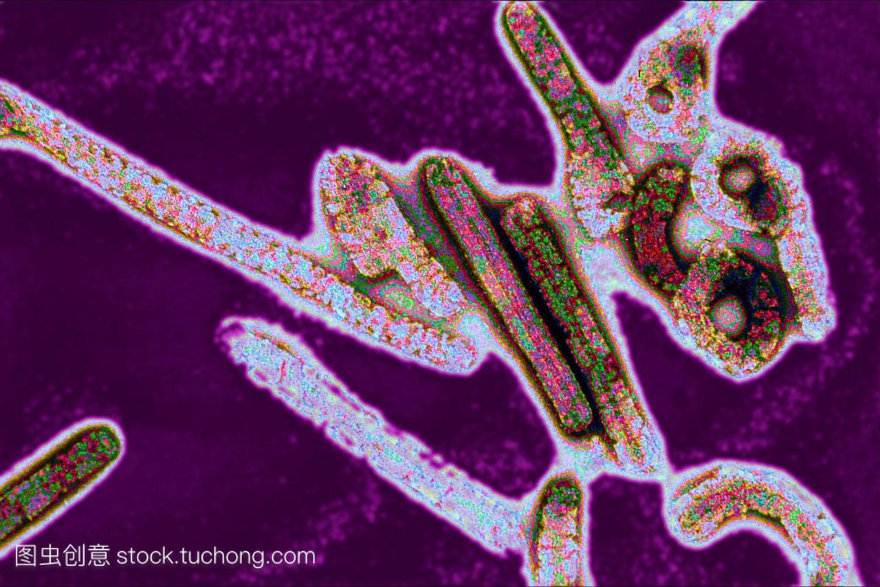 埃博拉病毒。彩色透射电子微图TEM的埃博拉