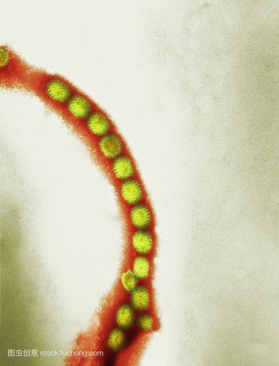 轮状病毒粒子的透射电子显微镜tem的轮状病毒