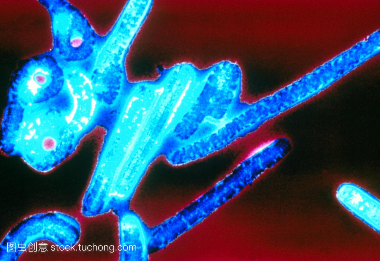 埃博拉病毒。彩色透射电子显微镜TEM通过埃
