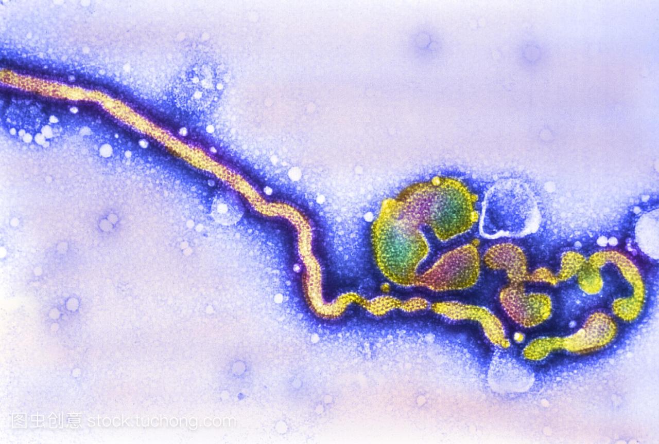 丙型流感病毒彩色透射电子显微镜temc群流行