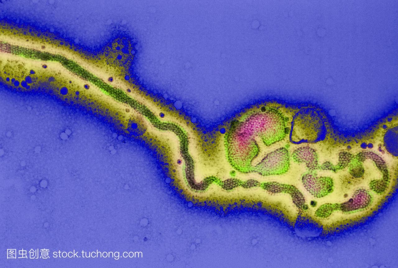 丙型流感病毒。彩色透射电子显微镜TEMC群流
