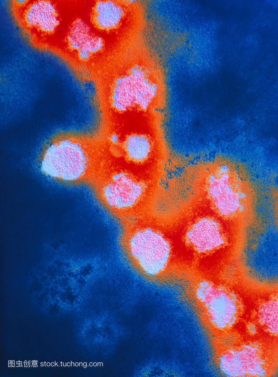风疹病毒。彩色透射电子显微摄影的风疹病毒,