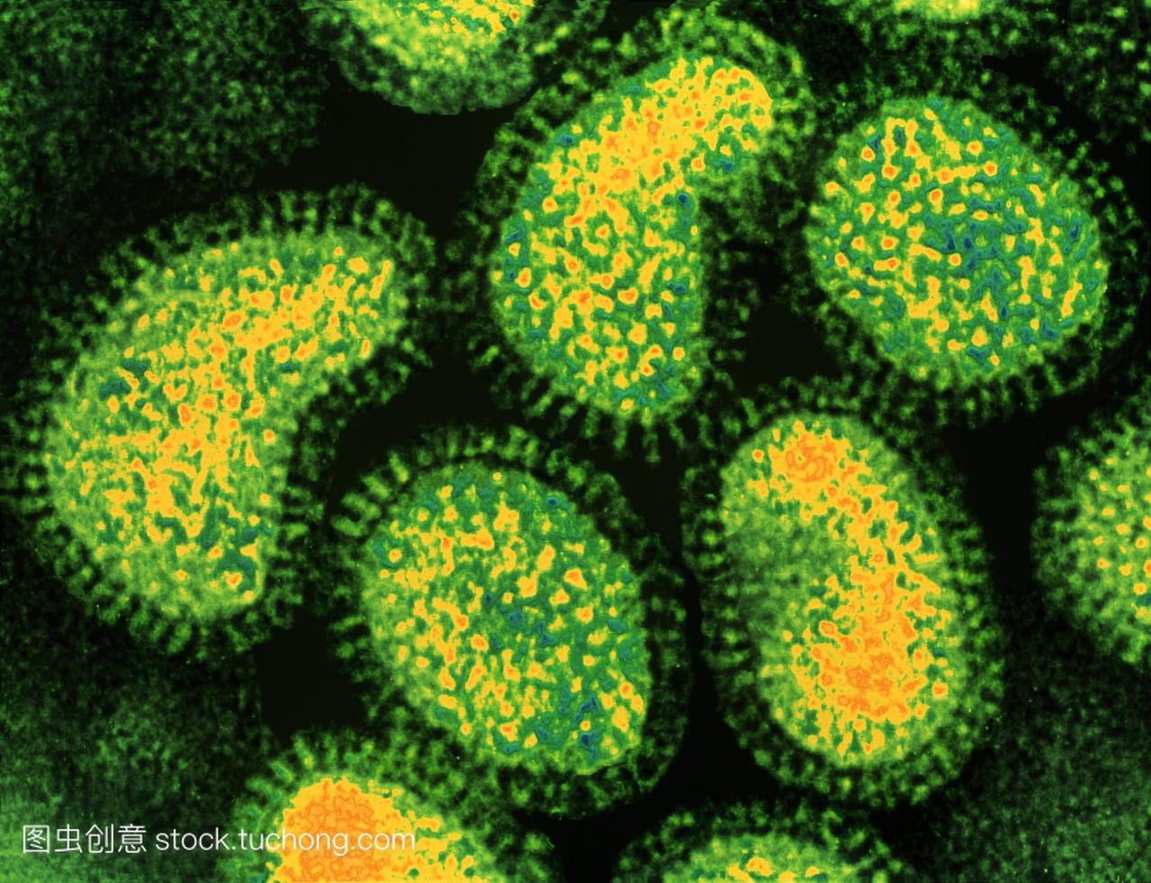 流感病毒。集群的彩色透射电子显微镜TEM流