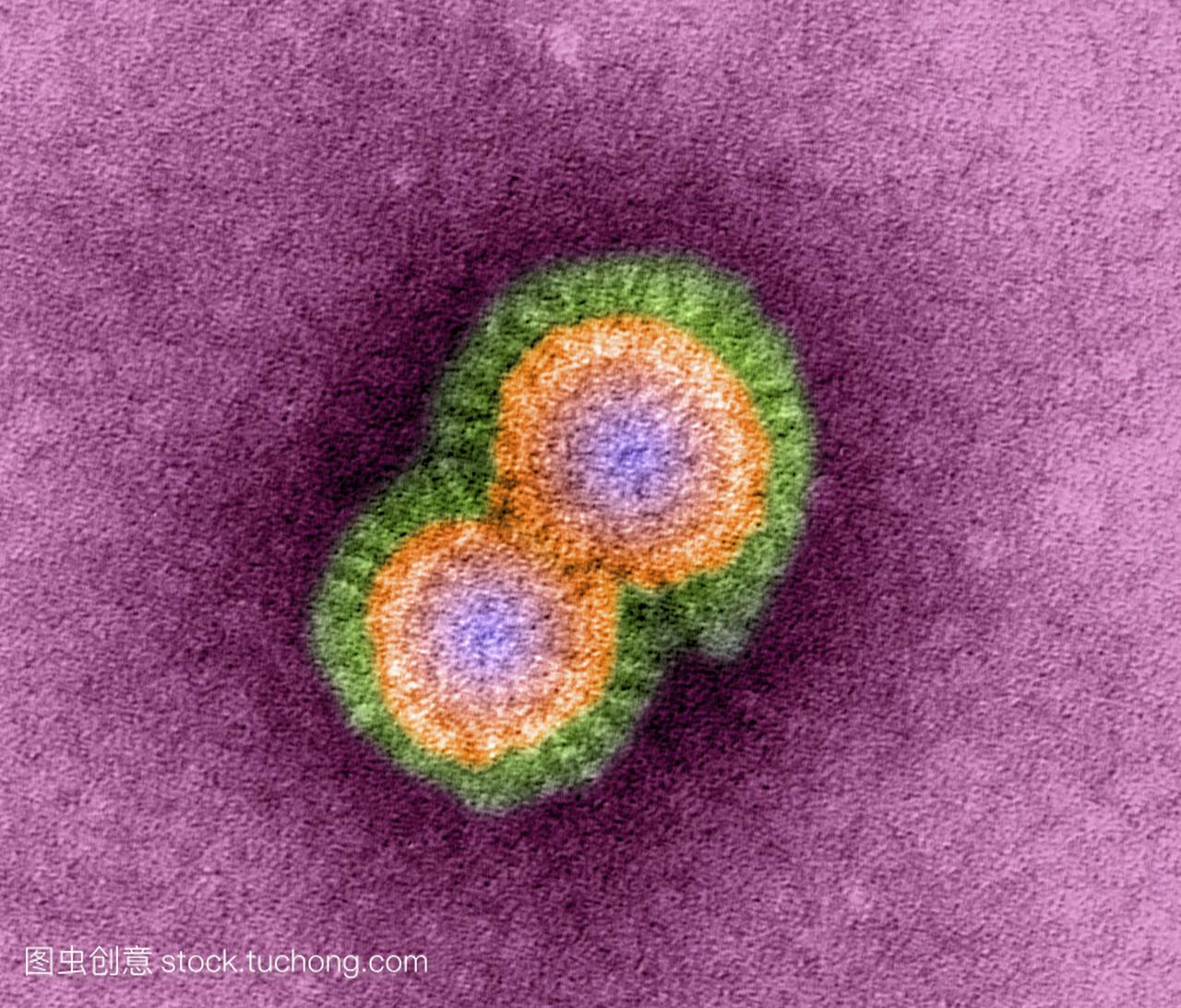 h5n1禽流感病毒粒子,彩色透射电子显微图tem。
