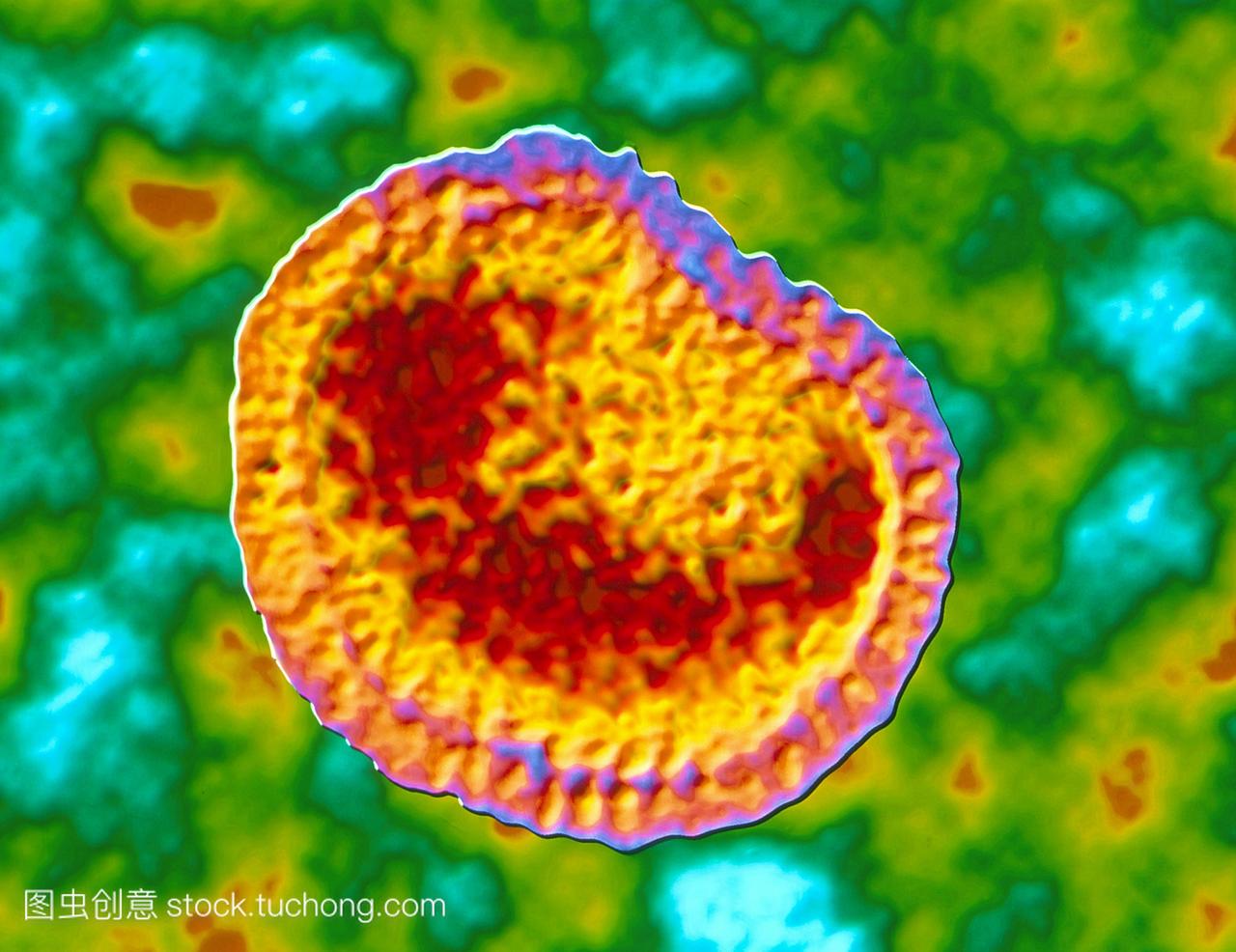 流感病毒。一种流行性感冒病毒的彩色透射电子