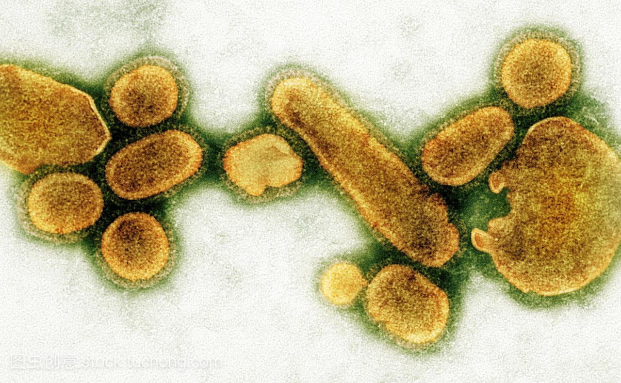 1918年h1n1流感病毒粒子棕色,彩色透射电子显