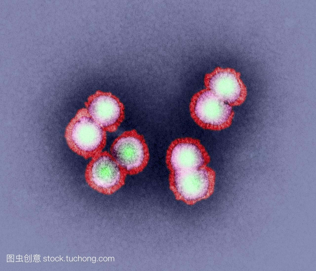 h5n1禽流感病毒粒子,彩色透射电子显微图tem。
