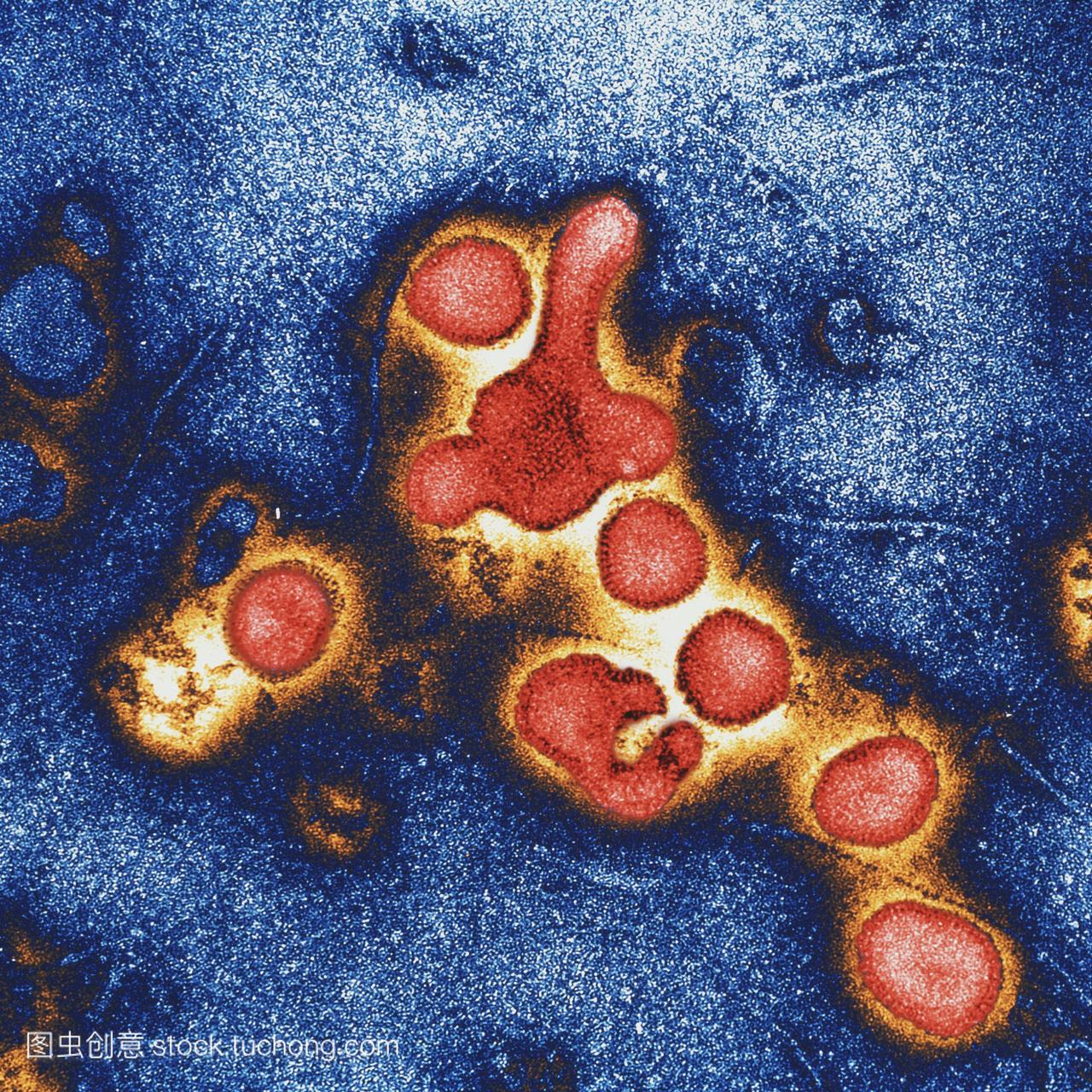 甲型流感病毒。流感病毒粒子红色的彩色透射电