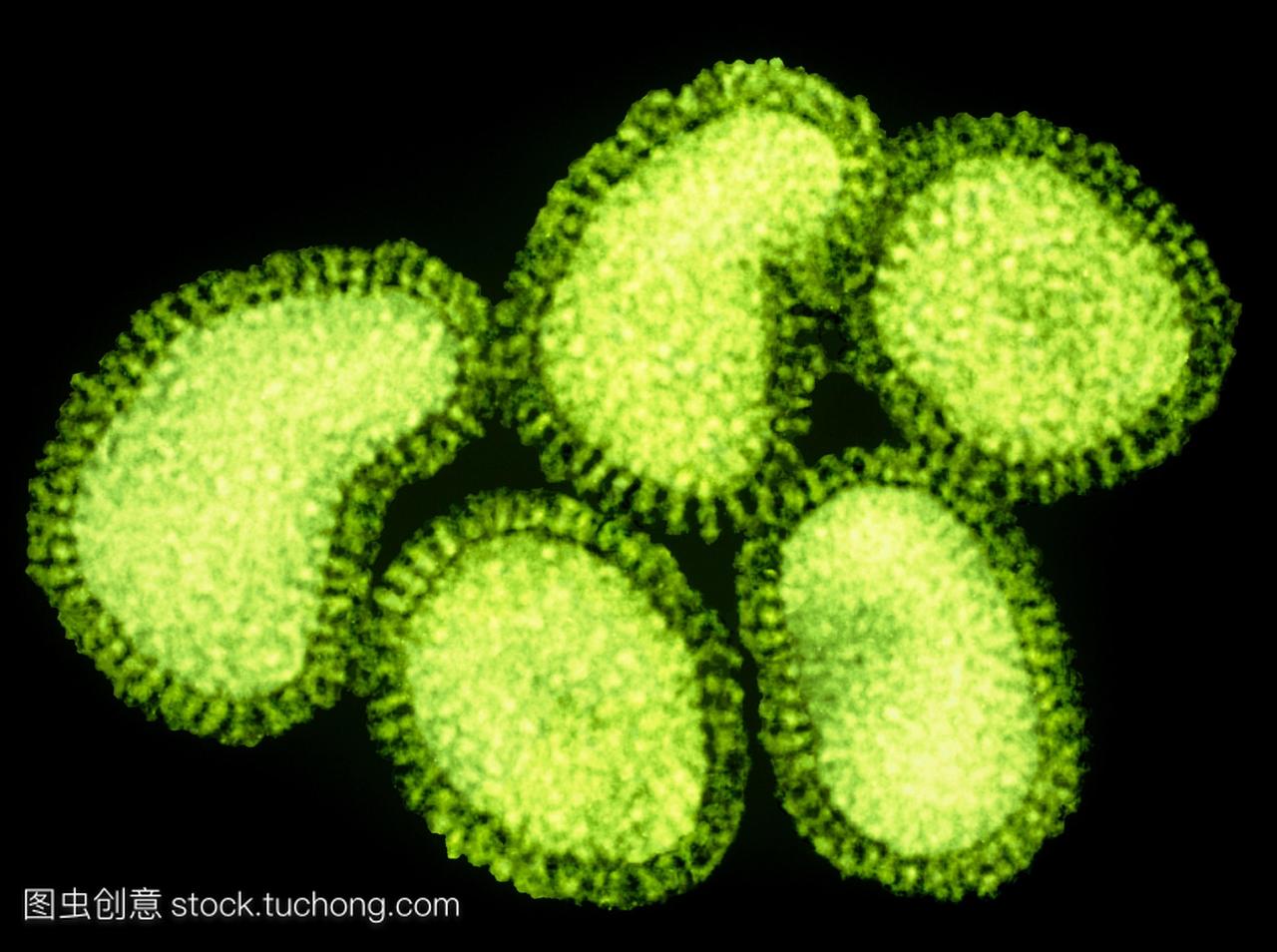 流感病毒。彩色透射电子显微镜TEM流感猪流