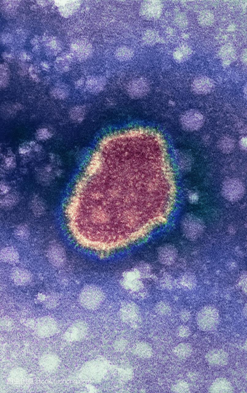 流感病毒。彩色透射电子显微镜TEM流感病毒