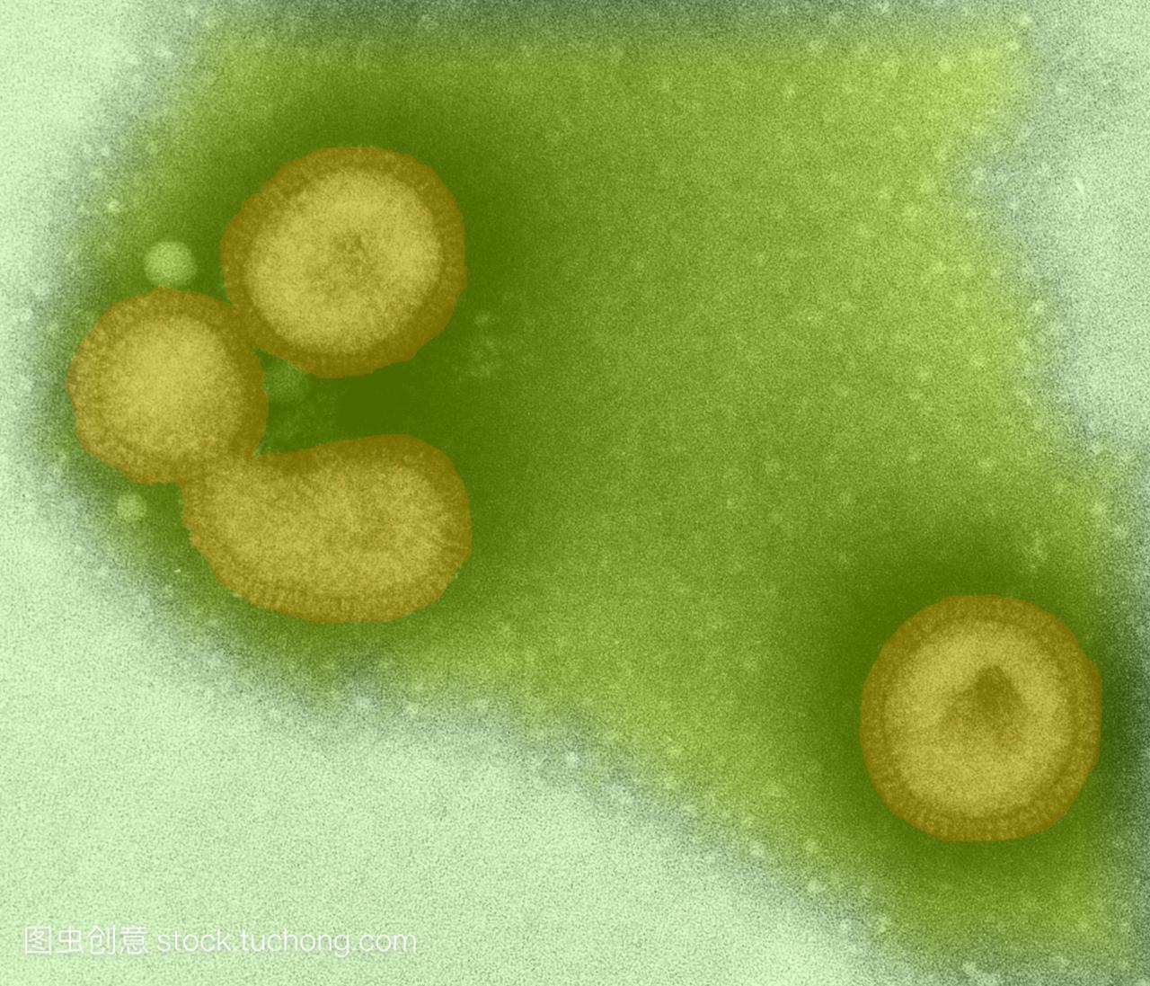 流感病毒。彩色透射电子显微镜TEM乙型流感