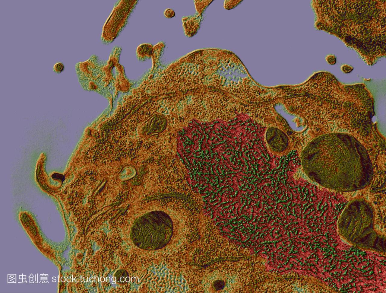 麻疹病毒彩色透射电子显微镜tem的部分通过人