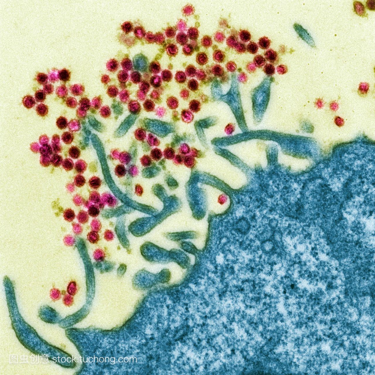 小鼠白血病病毒。细胞外的彩色透射电子显微镜