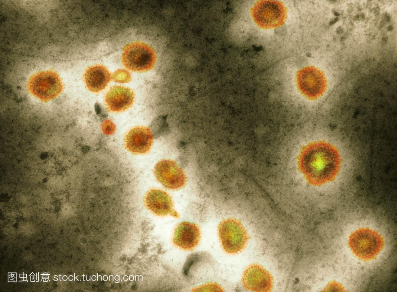 禽流感病毒粒子。彩色透射电子显微镜TEMaH
