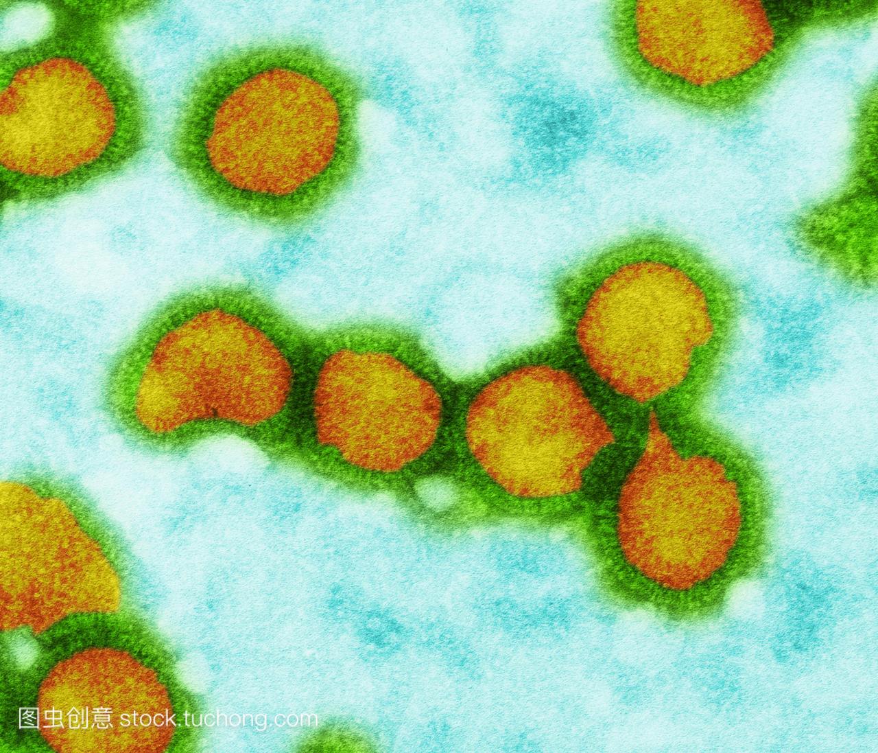 流感病毒彩色透射电子显微镜TEM。本节通过