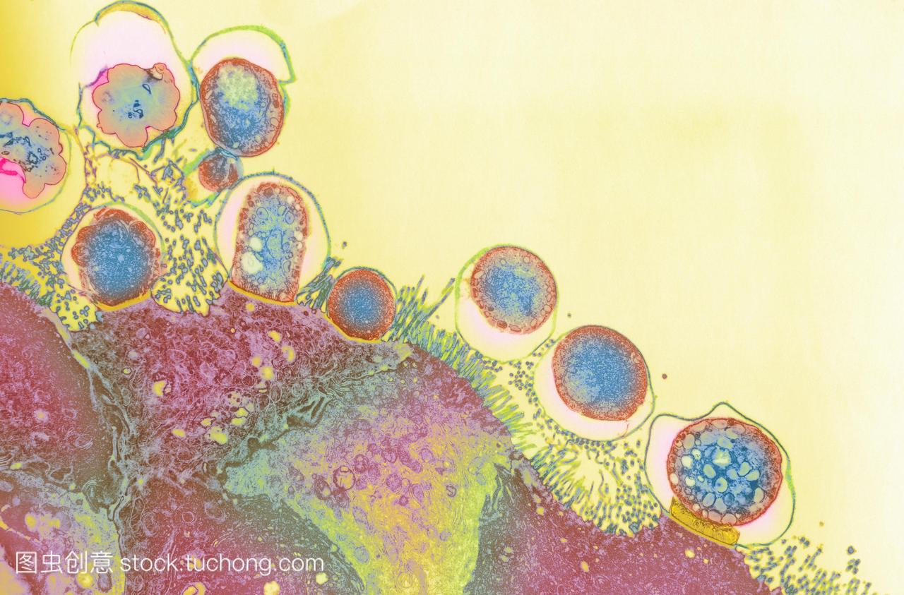 隐孢子虫病彩色透射电子显微镜tem肠道的表面
