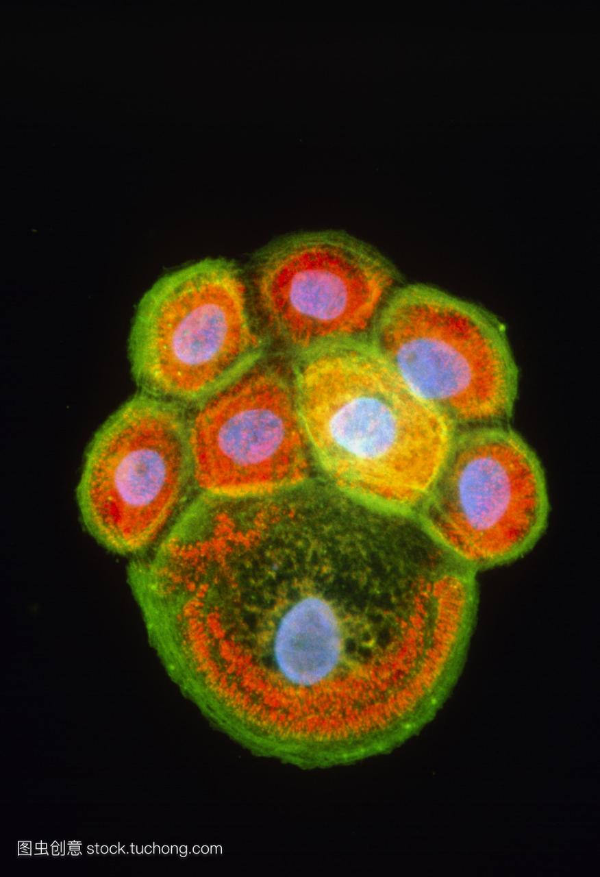 Immunofluorescent光显微照片殖民地鳞状细胞