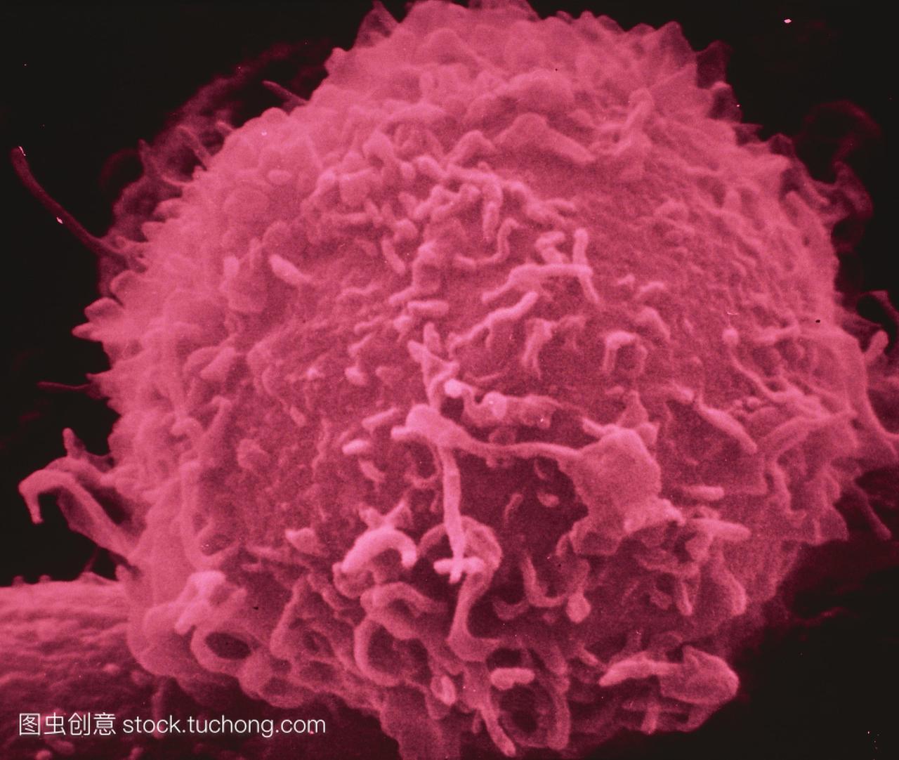色扫描电子显微摄影lymphoblastoid细胞淋巴细