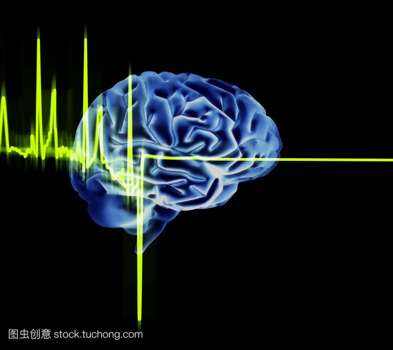 心电图跟踪和大脑。电脑绘图的心电图心电图跟
