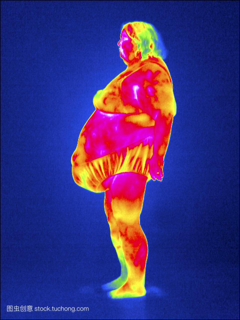 模型发布的肥胖女人热一热法显示了对象的表面