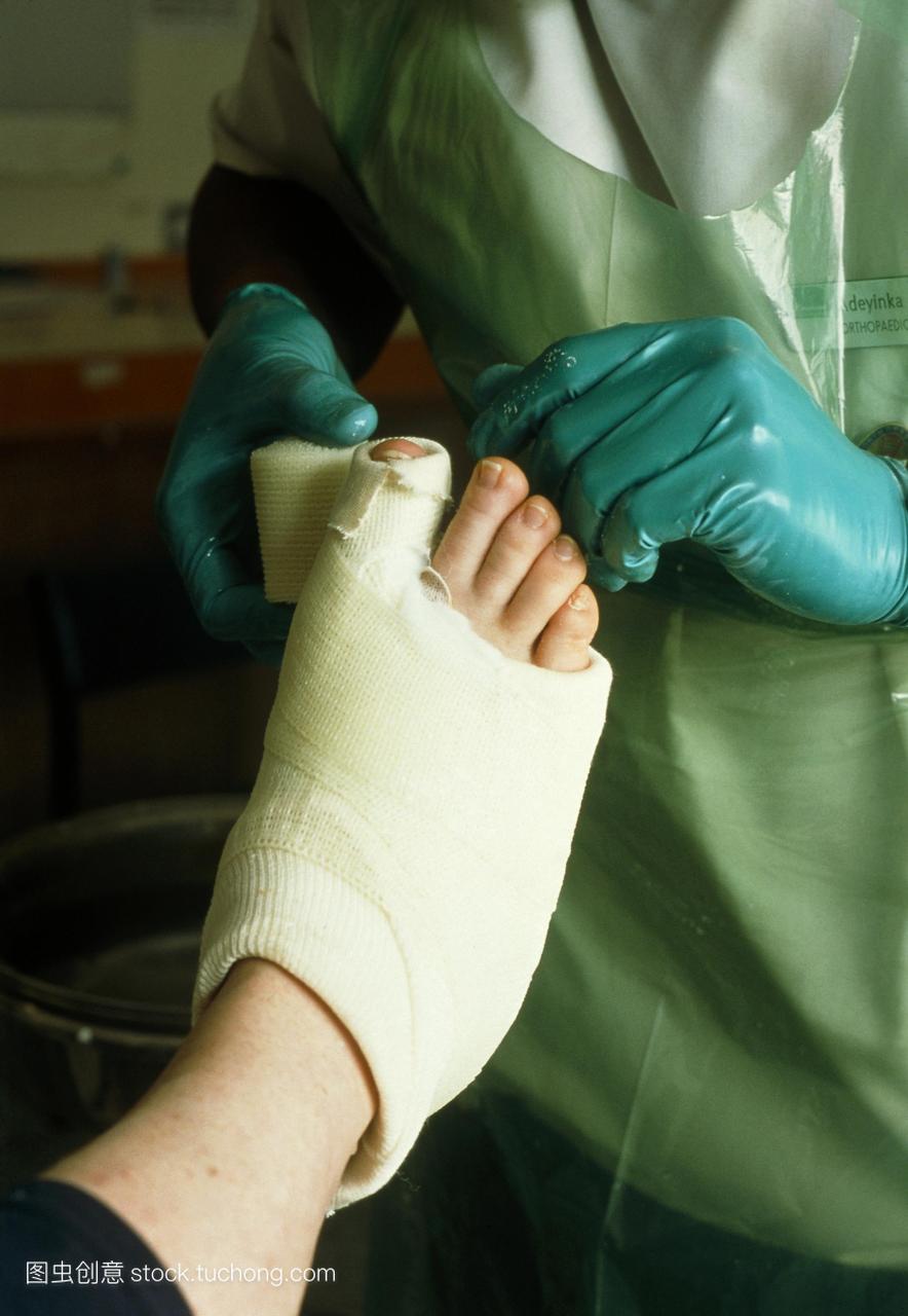 翻铸。一名医务工作者戴着手套,在病人的脚周