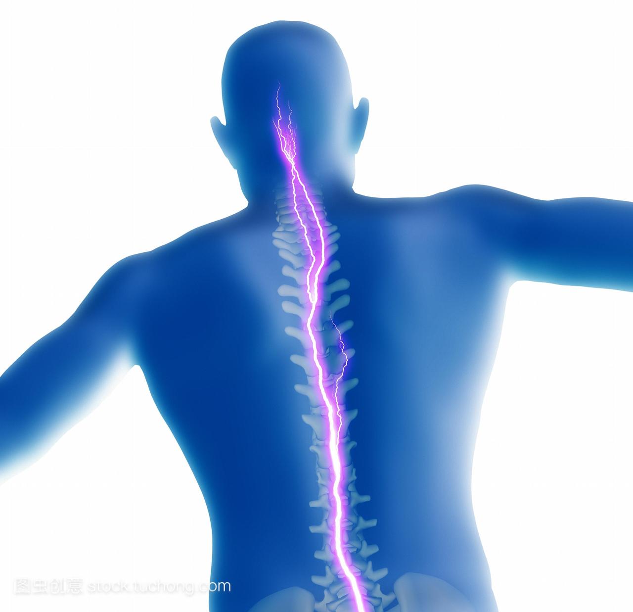 背部疼痛。一个背部疼痛的男人的概念电脑艺术