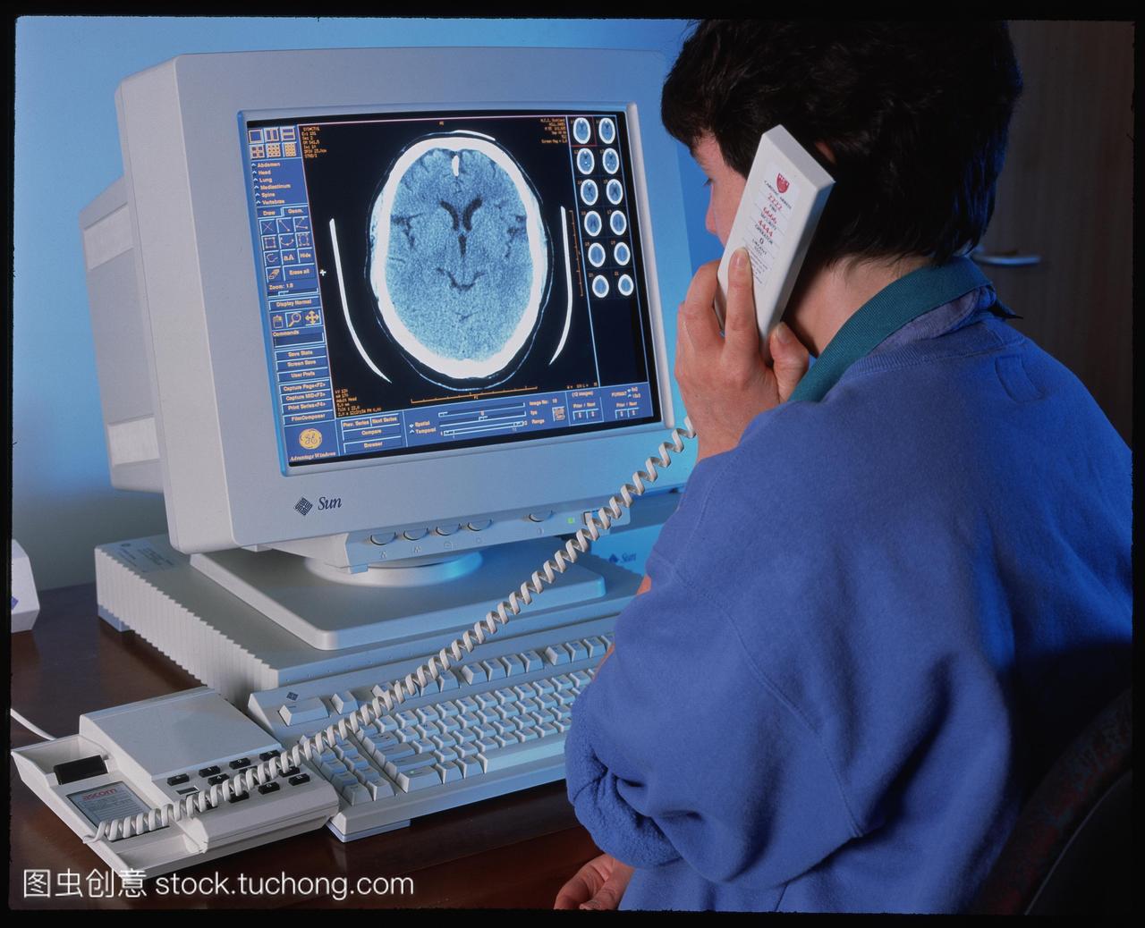 放射科医生考试--inesCT计算机断层扫描脑部扫