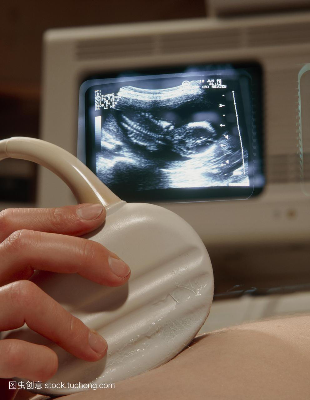 超声波在怀孕。女人的肚子怀孕初期接收超声波