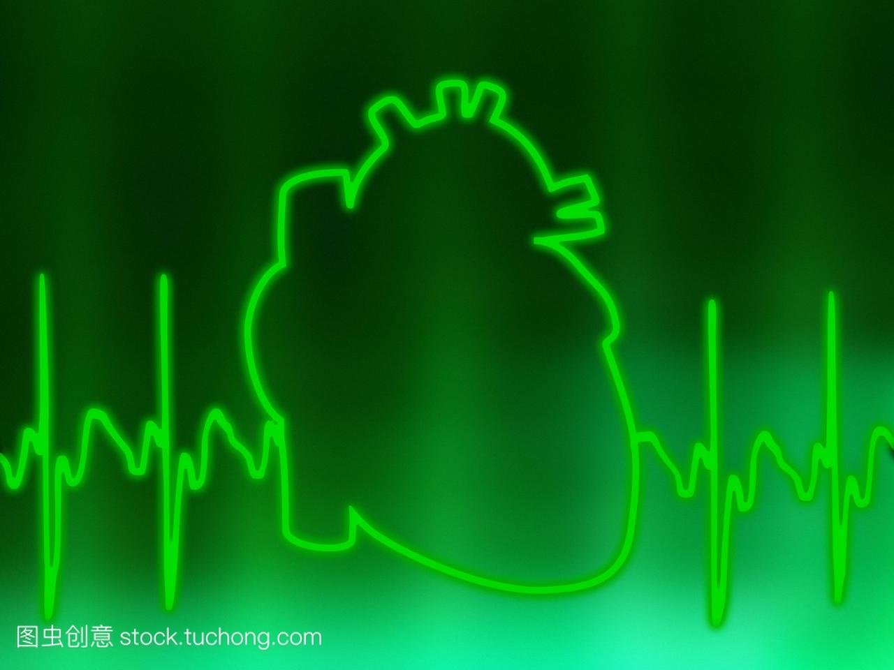 心电图ecg的电脑绘图,显示正常心率和