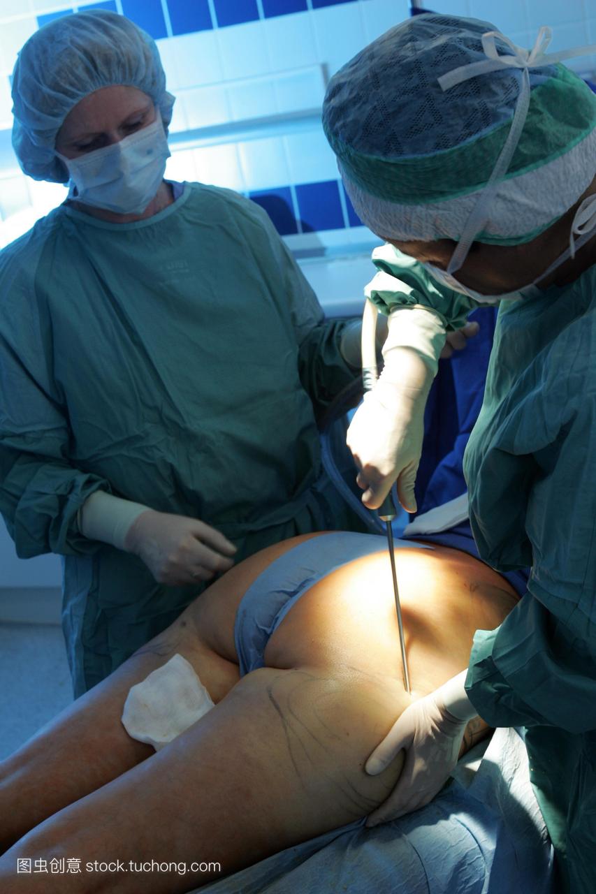 外科医生在吸脂手术时将导管插入病人臀部的切