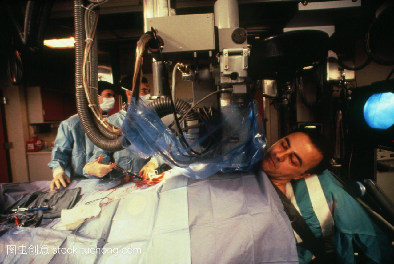 冠状动脉血管成形术是在美国医院的男性病人身