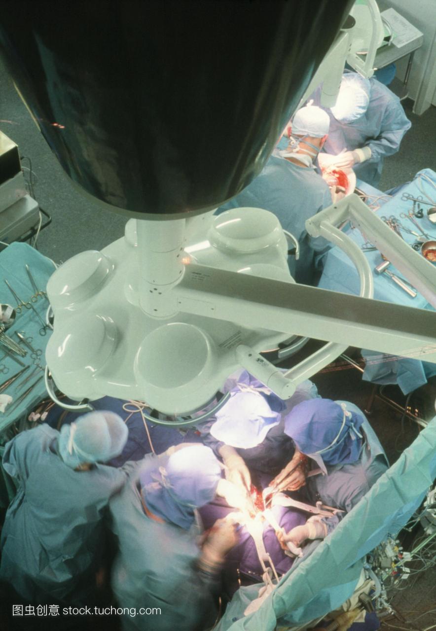 肝脏移植手术。手术室的手术团队进行肝脏移植