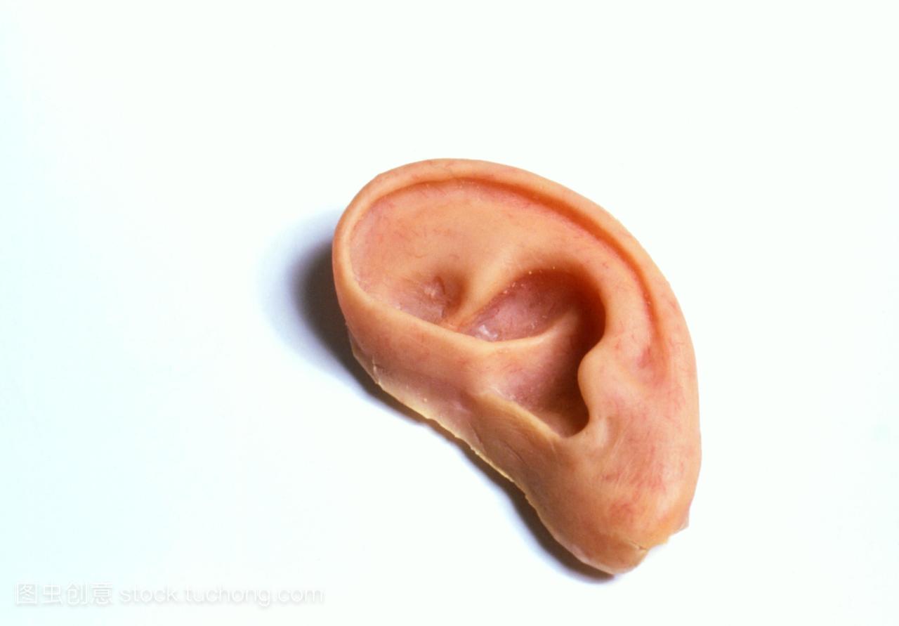 人工耳。人工耳用作假肢。这是一个假耳廓,耳
