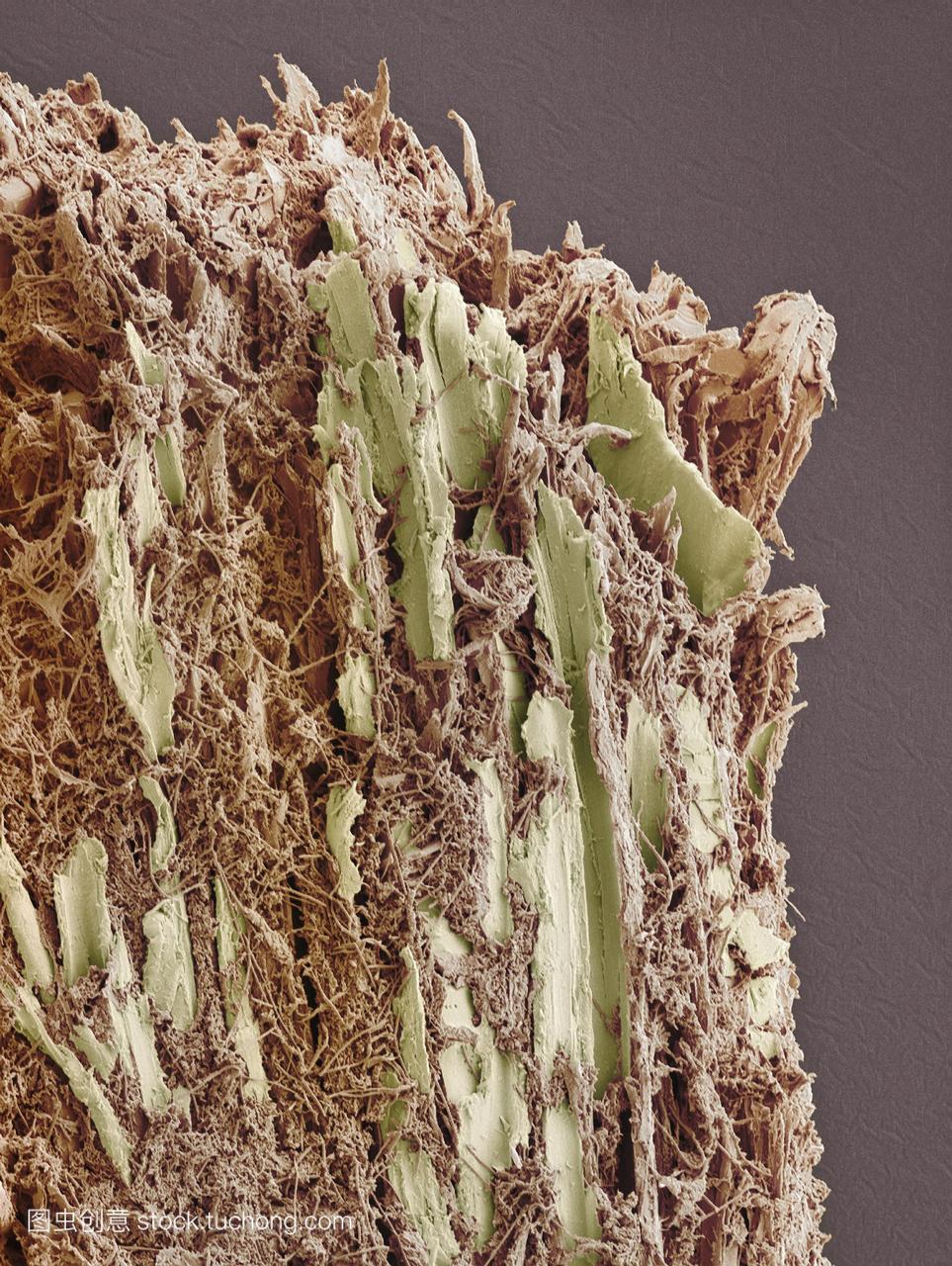 牙菌斑布朗使用牙签黄色彩色扫描电子显微摄影