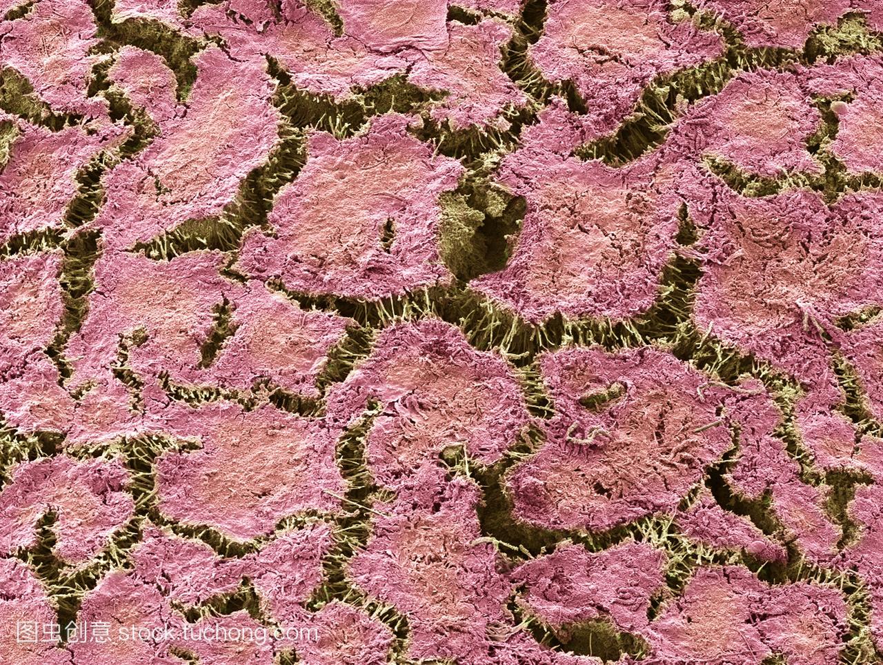 牙菌斑,彩色扫描电镜sem。菌斑由一层嵌入糖