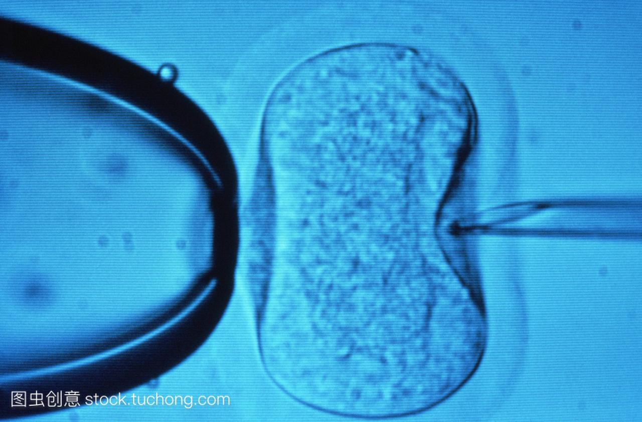 在体外受精IVF研究光学显微镜图像显示针右被
