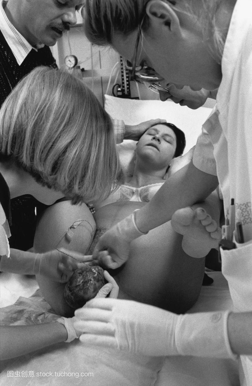 布。分娩。婴儿的头出现在分娩。一名助产士戴