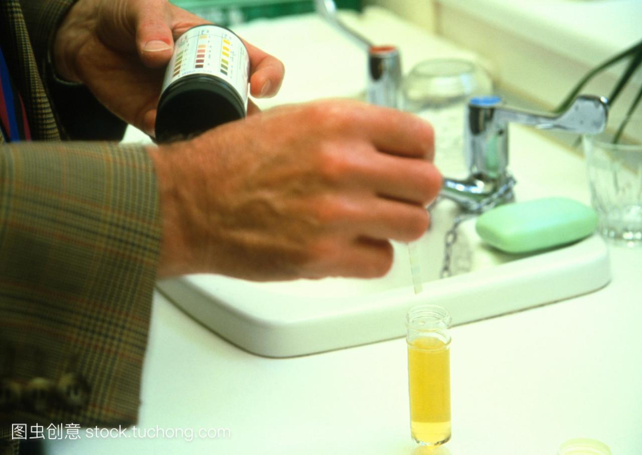 尿液分析。医生浸渍尿检粘在瓶尿液。这个La