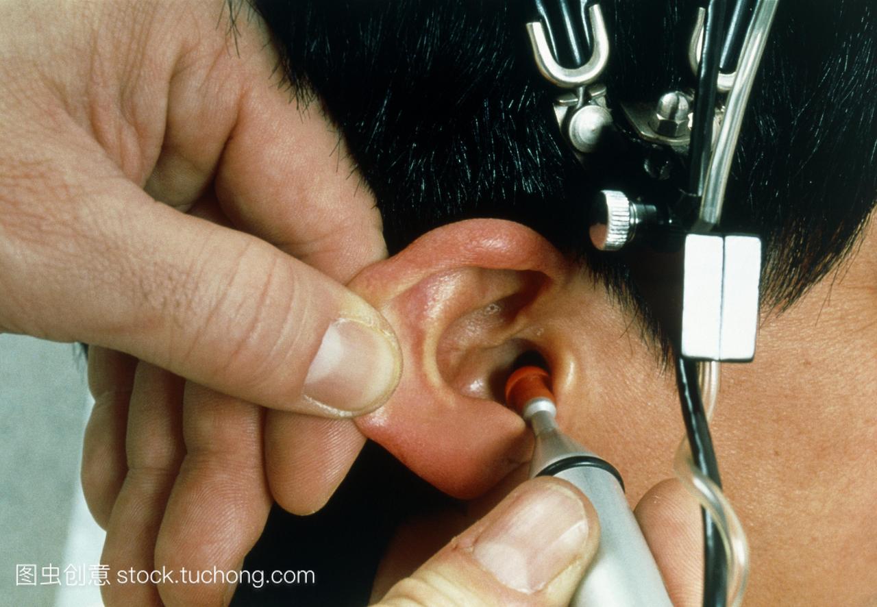 听力测试。人工耳蜗植入后的听力测试。一名技