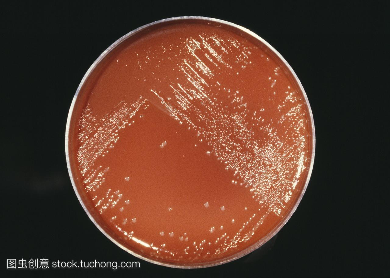 淋病细菌淋球菌殖民地白色琼脂培养基上培养布