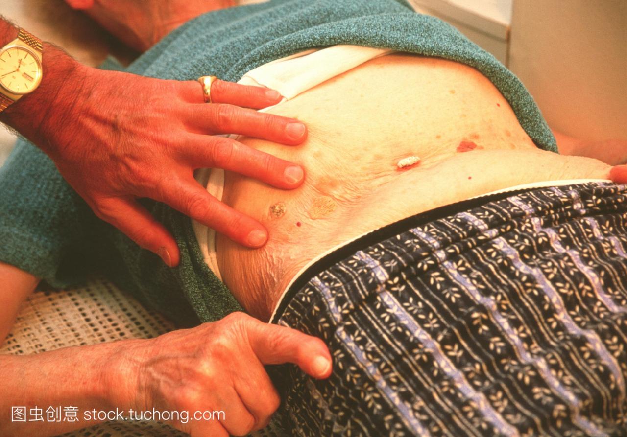 一般练习gp医生检查一个老妇人的胃的皮肤生