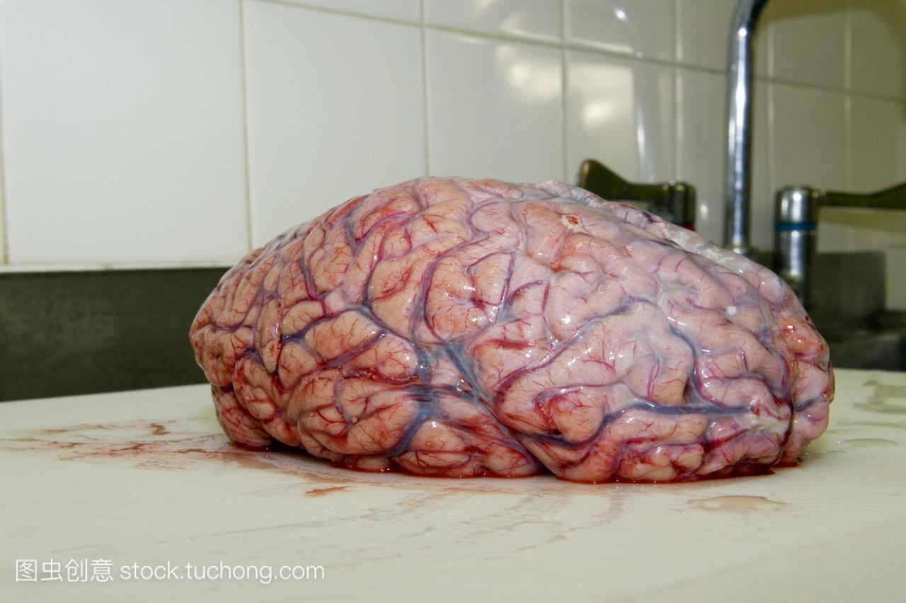 大脑验尸。位于头部大脑中枢神经系统是中央机